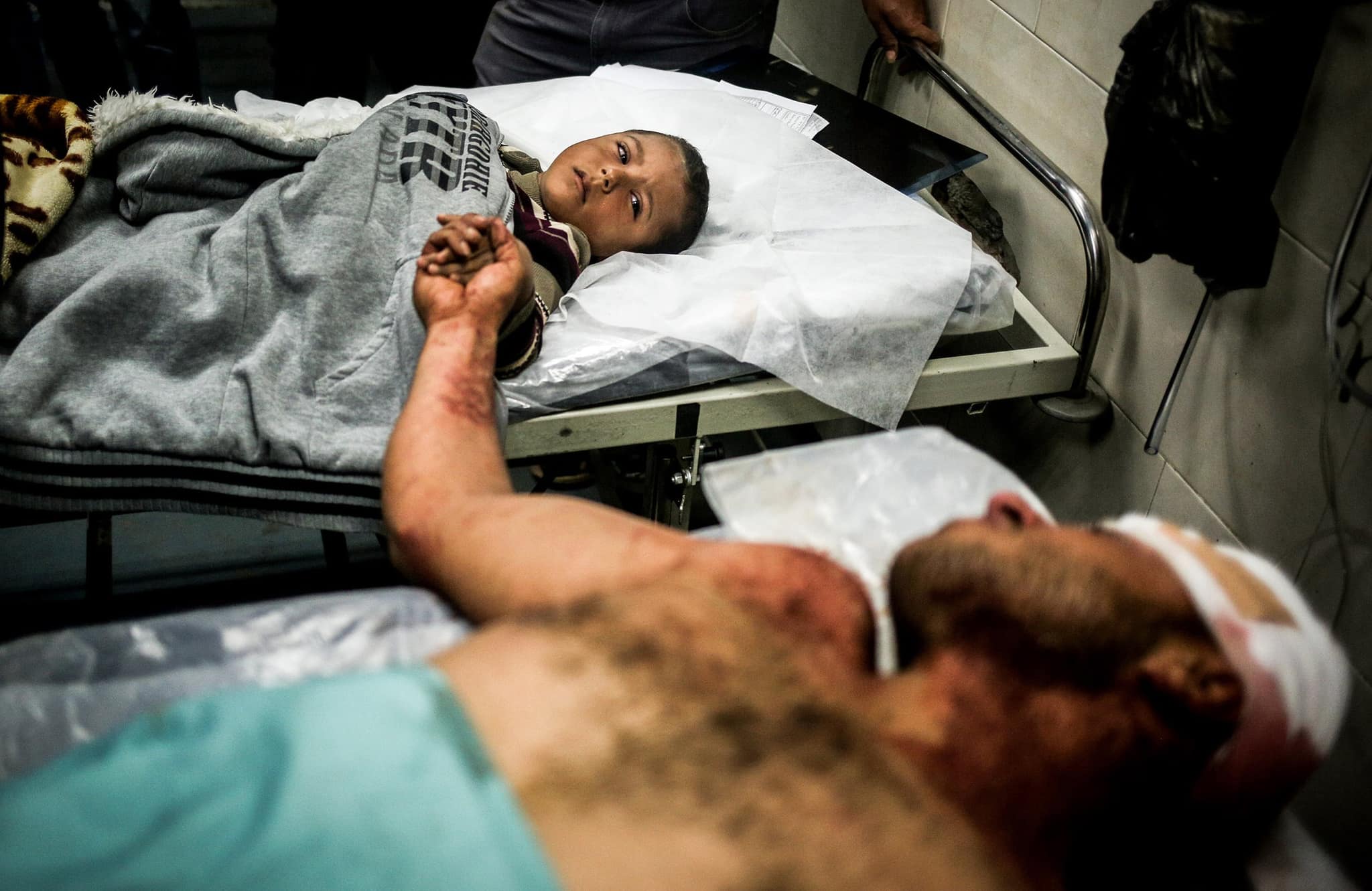 رجل جريح وطفل على نقّالتين، جنبًا إلى جنب في ممر المستشفى.